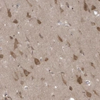 Immunohistochemical staining of human cerebral cortex shows strong cytoplasmic positivity in neuronal cells.