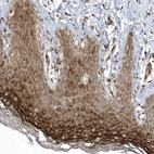 Immunohistochemical staining of human skin shows strong cytoplasmic positivity in squamous epithelial cells.