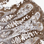 Immunohistochemical staining of human colon shows strong cytoplasmic positivity in glandular cells.