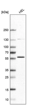 Western blot analysis in human cell line HEL.