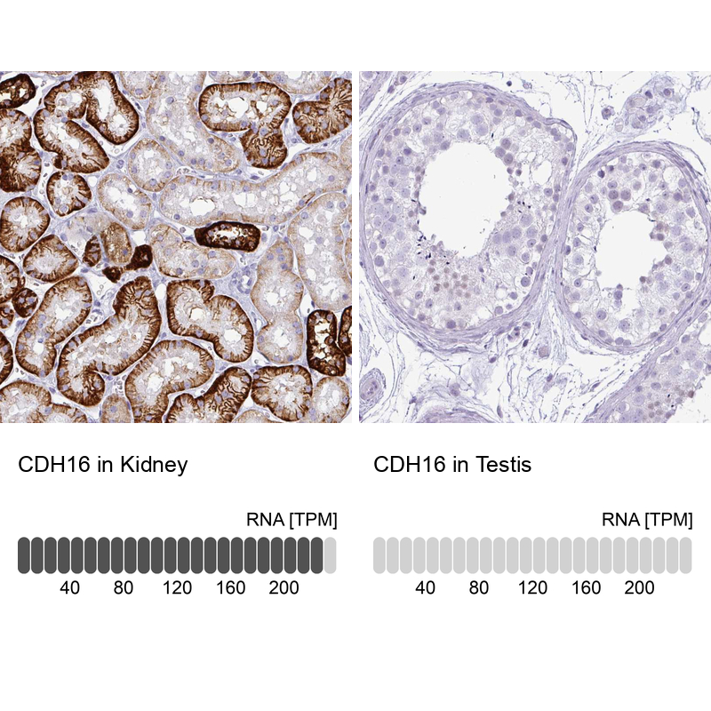 Anti-CDH16 Antibody