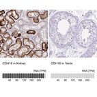 Anti-CDH16 Antibody