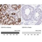Anti-CDH16 Antibody