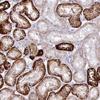 Immunohistochemical staining of human kidney shows strong membranous positivity in cells in tubules.