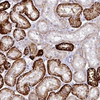 Immunohistochemical staining of human kidney shows strong membranous positivity in cells in tubules.