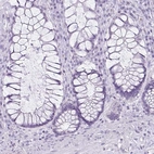 Immunohistochemical staining of human rectum shows no positivity in glandular cells.