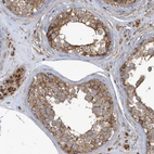 Immunohistochemical staining of human Testis shows moderate granular cytoplasmic positivity in cells in seminiferous ducts and Leydig cells.