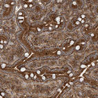Immunohistochemical staining of human Duodenum shows strong granular cytoplasmic positivity in glandular cells.