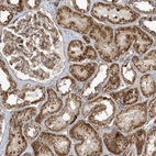 Immunohistochemical staining of human Kidney shows moderate granular cytoplasmic positivity in cells in tubules.