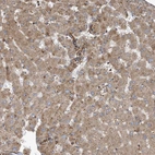 Immunohistochemical staining of human Liver shows moderate granular cytoplasmic positivity in hepatocytes.
