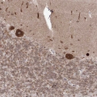 Anti-DNAJB2 Antibody