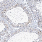 Anti-PLEKHG4B Antibody