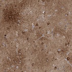 Anti-CALN1 Antibody