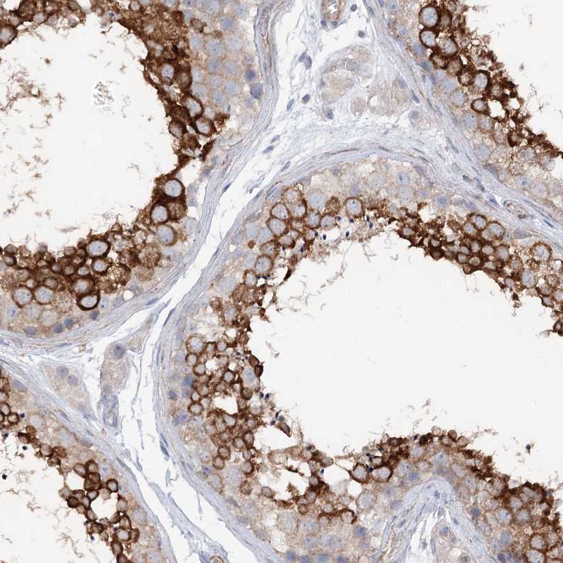 Anti-LARP1B Antibody