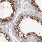 Anti-LARP1B Antibody