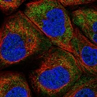 Immunofluorescent staining of human cell line A-431 shows localization to cytosol.