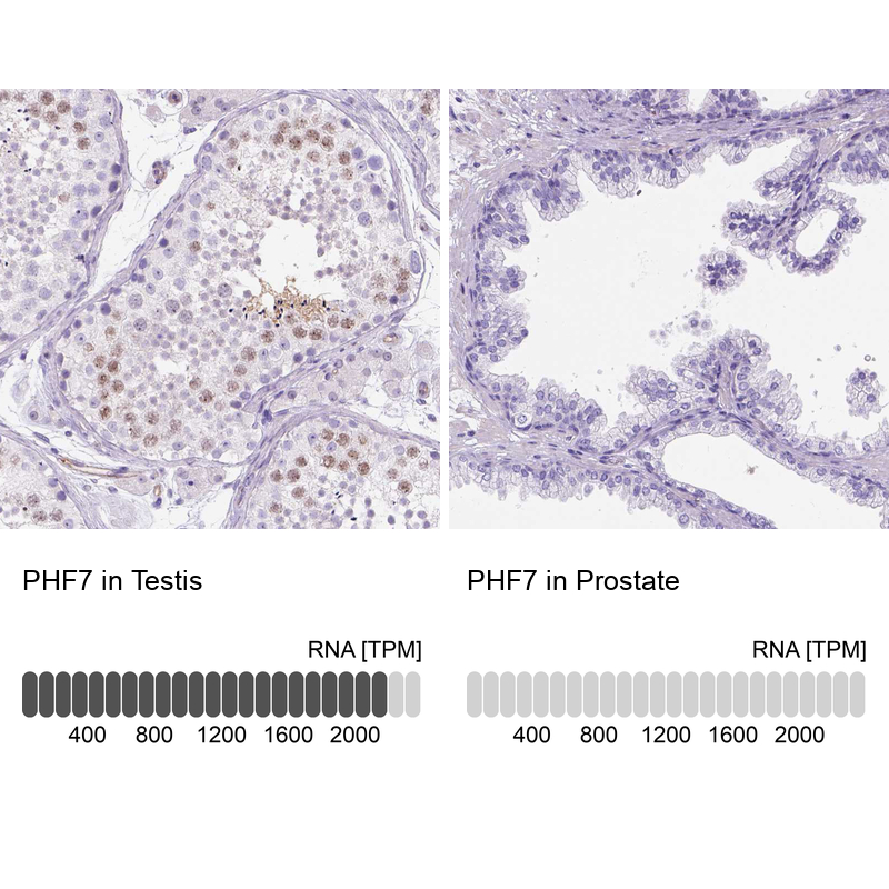 Anti-PHF7 Antibody