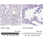 Anti-PHF7 Antibody