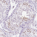 Immunohistochemical staining of human testis shows moderate nuclear positivity.