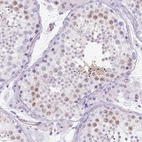 Immunohistochemical staining of human testis shows moderate nuclear positivity.