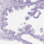 Immunohistochemical staining of human prostate shows no positivity in glandular cells as expected.