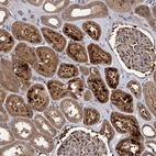 Immunohistochemical staining of human kidney shows moderate to strong cytoplasmic positivity in cells in tubules.