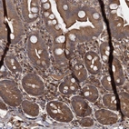 Immunohistochemical staining of human gastrointestinal shows moderate cytoplasmic positivity in glandular cells.