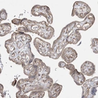 Immunohistochemical staining of human placenta shows weak cytoplasmic positivity in glandular cells.