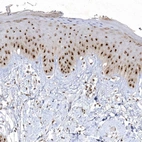 Anti-NPM3 Antibody