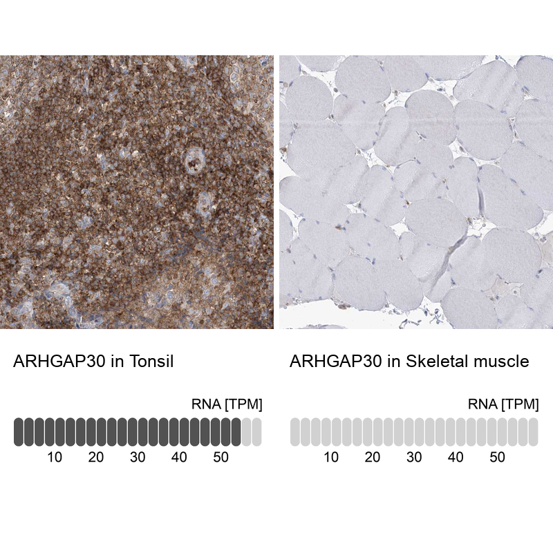 Anti-ARHGAP30 Antibody