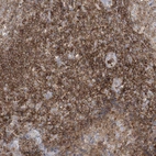Immunohistochemical staining of human tonsil shows strong cytoplasmic positivity in non-germinal center cells.