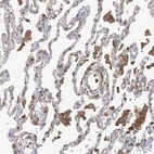 Immunohistochemical staining of human lung shows moderate cytoplasmic positivity in macrophages.
