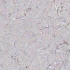 Immunohistochemical staining of human pancreas shows no positivity in exocrine glandular cells as expected.