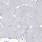 Immunohistochemical staining of human skeletal muscle shows no positivity in myocytes as expected.