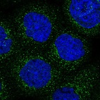 Immunofluorescent staining of human cell line A-431 shows localization to vesicles.