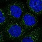 Immunofluorescent staining of human cell line A-431 shows localization to vesicles.