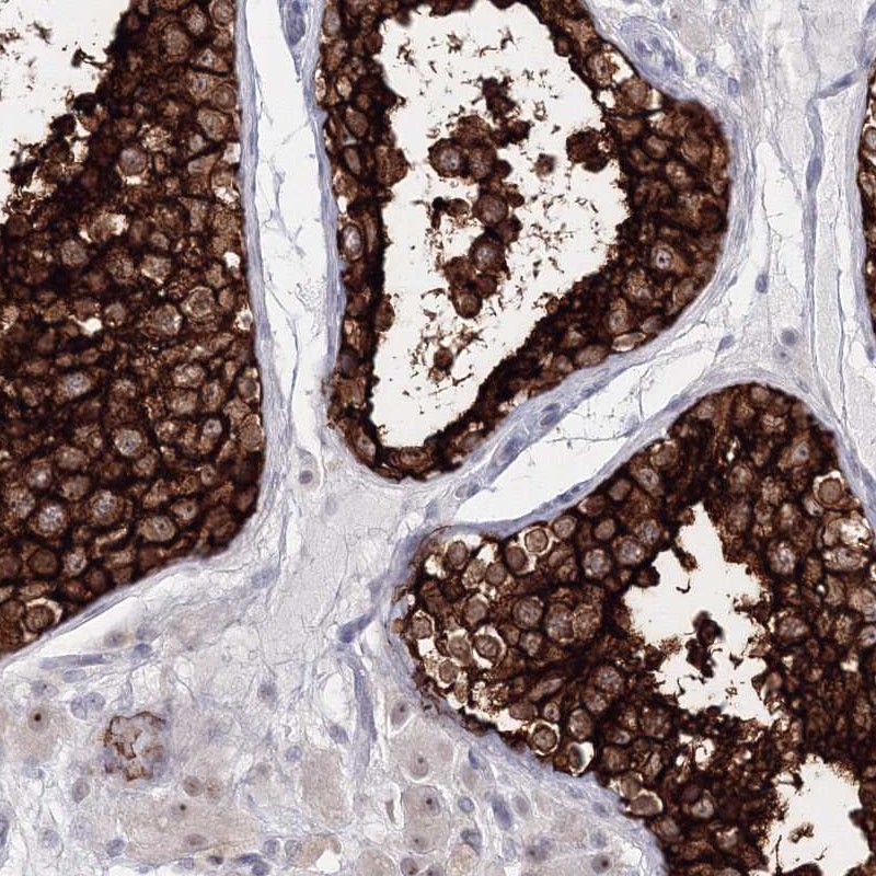 Anti-VSIG1 Antibody