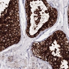 Anti-VSIG1 Antibody
