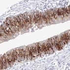 Immunohistochemical staining of human urinary bladder shows strong membranous positivity in urothelial cells.