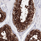 Immunohistochemical staining of human testis shows strong membranous positivity in cells in seminiferous ducts.