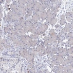 Immunohistochemical staining of human pancreas shows no membranous positivity in exocrine glandular cells as expected.