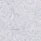 Immunohistochemical staining of human liver shows no membranous positivity in hepatocytes as expected.