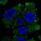 Immunofluorescent staining of human cell line PC-3 shows localization to cytosol & vesicles.