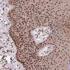 Anti-GNL3L Antibody
