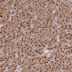 Immunohistochemical staining of human pancreas shows strong nuclear positivity in exocrine glandular cells.