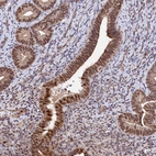 Immunohistochemical staining of human endometrium shows moderate nuclear positivity in glandular cells.