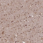 Immunohistochemical staining of human cerebral cortex shows strong nuclear positivity in glial cells.