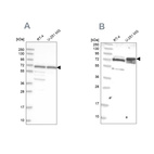 Western blot analysis using Anti-GNL3L antibody HPA036314 (A) shows similar pattern to independent antibody HPA036315 (B).