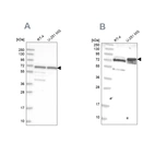 Western blot analysis using Anti-GNL3L antibody HPA036314 (A) shows similar pattern to independent antibody HPA036315 (B).