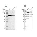 Western blot analysis using Anti-HOMEZ antibody HPA036317 (A) shows similar pattern to independent antibody HPA036316 (B).